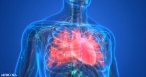 Az étrend megváltoztatása önmagában már előnyös a kardiometabolikus egészségedre